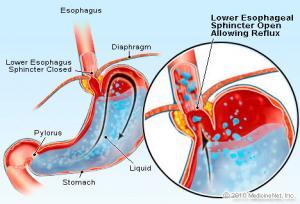 GERD Physiology